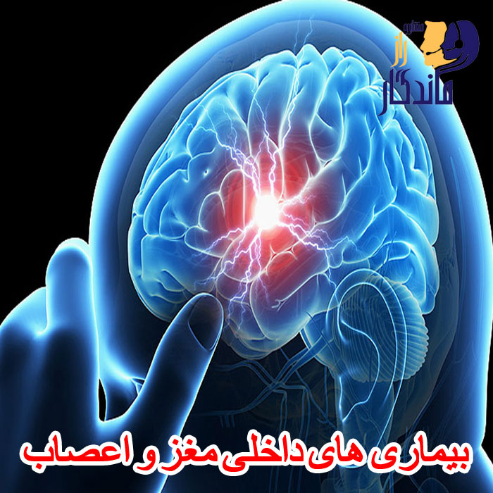 بیماری های داخلی مغز و اعصاب