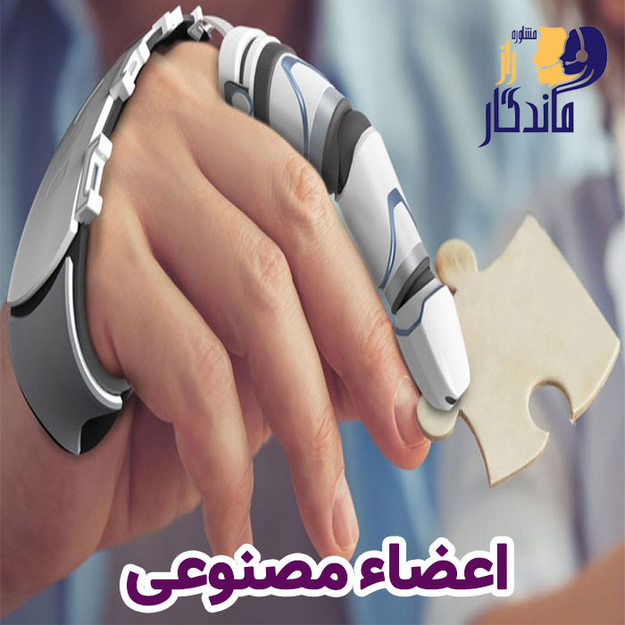 اعضاء مصنوعی