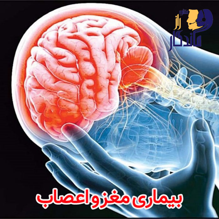 بیماری های مغز و اعصاب